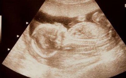 遂宁市较好的试管医院是哪家？附遂宁市试管医院排名介绍！