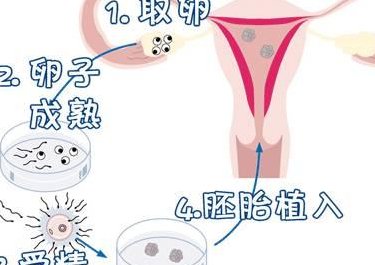 2026重庆市中医院试管婴儿价格明细发布，了解造娃的全部费用！